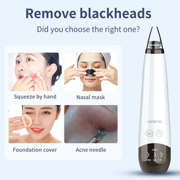 Blackhead Remover Vacuum Acne Pimple Black Spot Suction Electric Facial Pore